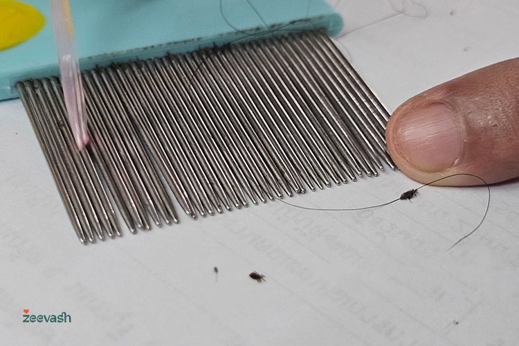 چطور بفهمیم شپش از بین رفته است؟